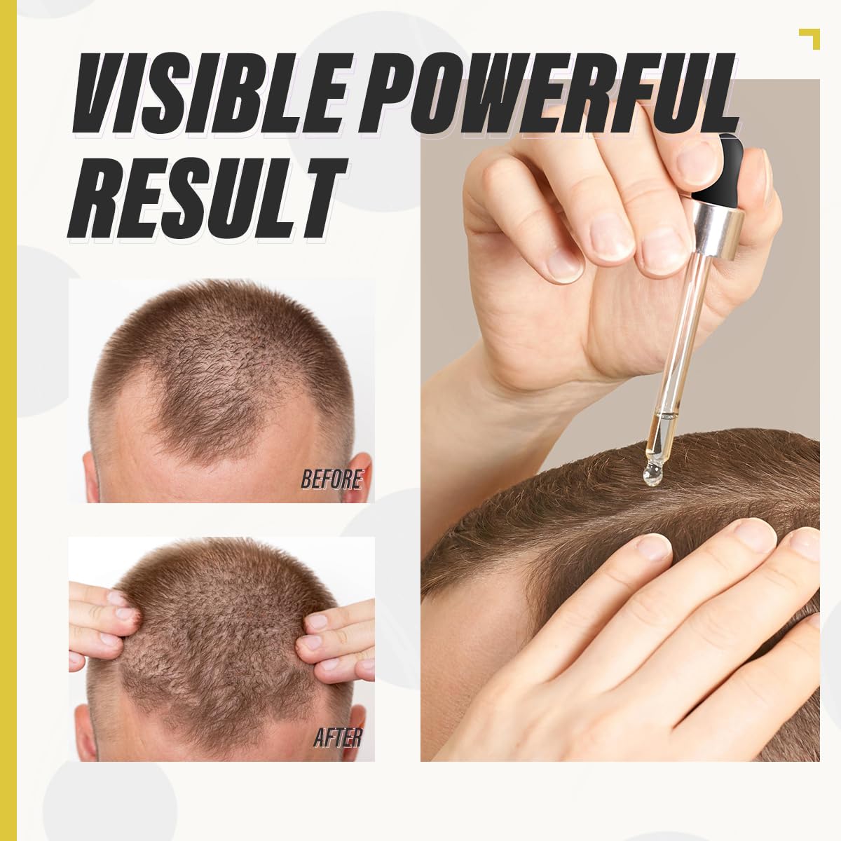 Biotin Hair Growth Serum for Stronger & Thicker Hair