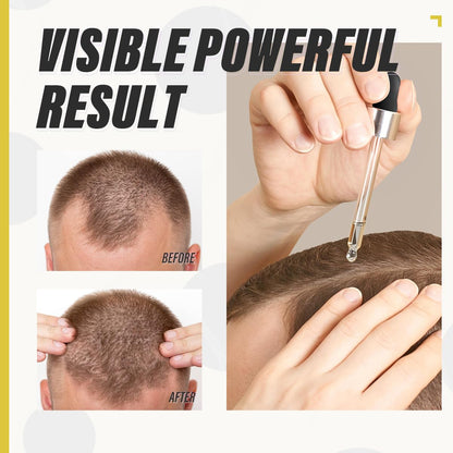 Biotin Hair Growth Serum for Stronger & Thicker Hair